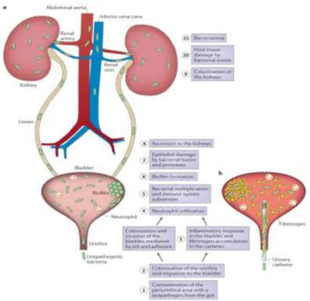Gambar 2. Patogenesis ISK (Flores-Mireles et al, 2015) 