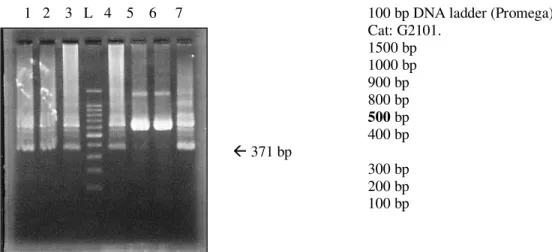 Gambar 5. Hasil RT-nested PCR  mRNA Ck 19 didalam darah tepi dengan primer Ck 19-3 dan  Ck 19-4 menghasilkan fragmen 371 bp