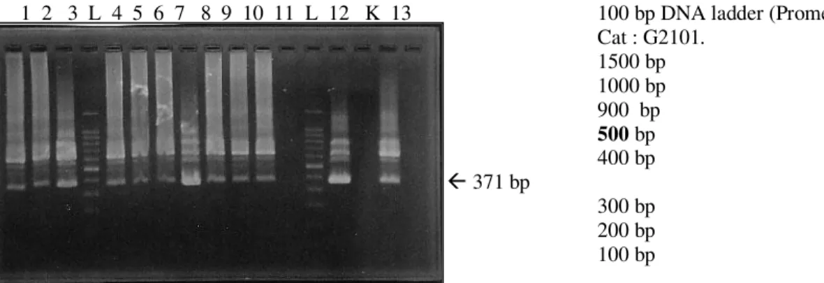 Gambar 6. Hasil RT- nested PCR mRNA Ck 19 didalam darah tepi dengan primer Ck 19-3 dan Ck 19-4, menghasilkan  fragmen sepanjang 371 bp