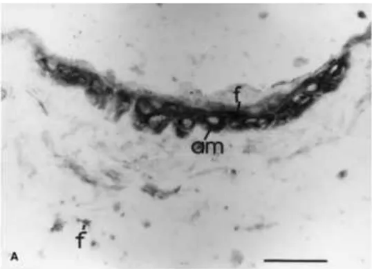 Gambar 4. Gambaran immunostain IGF-1 pada wharton jelly, Keterangan: