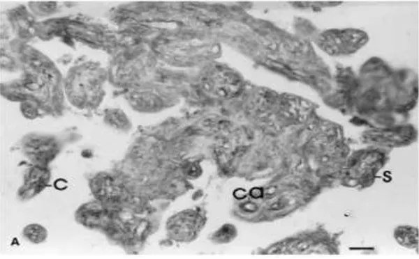 Gambar 6. Gambaran immunocytochemical IGF-1 pada plasenta manusia.
