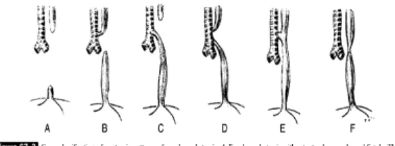 Gambar 1. Gross Classification of anatomic pattern of 