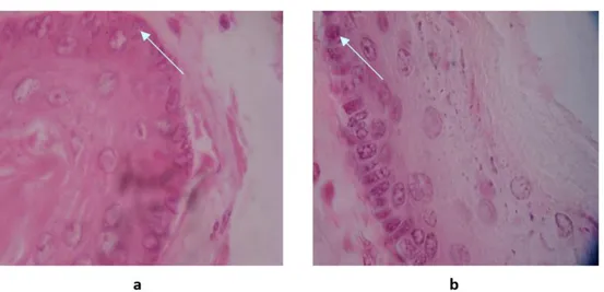 Gambar 2. Gambaran bronkus tikus dengan pengecatan Hematoksilin Eosin dalam  perbesaran 10 x 40