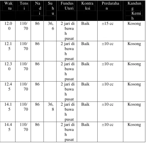 Tabel 4.4. Hasil pemantauan ibu  Wak tu  Tensi  Na d i  Su h u   Fundus  Uteri  Kontraksi  Perdarahan  Kandung Kemi h  12.0 0  110/ 70  86  36, 6  2 jari di bawa h  pusat   Baik  ±15 cc  Kosong  12.1 5  110/ 70  86  2 jari di bawa h  pusat  Baik  ±10 cc  K