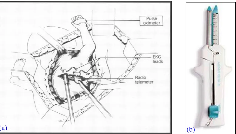 Gambar 3.  (a) Sebuah radiotelemeter yang memungkinkan pemantauan intraoperatif dan pasca operatif dalam bentuk elektrokardiogram (EKG) dan denyut jantung