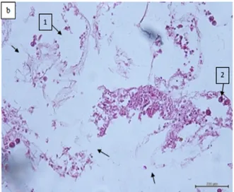Gambar 4. Histologi jaringan Karang                     Acropora sp. Sehat/Normal.                     Terlihat jaringan epidermis masih                      bagus (1) dan zooxanthellae                      masih banyak ditemukan (2)