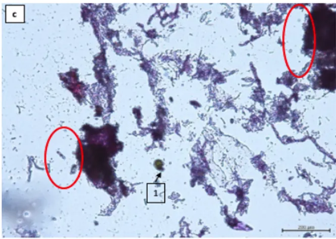 Gambar 9. Histologi jaringan karang                     Acropora yang terkena penyakit                     white band
