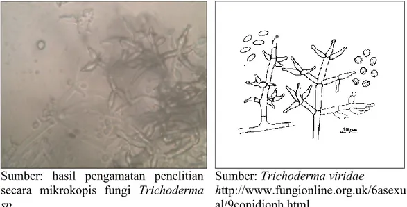 Gambar 6. Morfologi mikroskopis isolat fungi YLF8 (Trichoderma viridae)                              pembesaran 10 x 100) 