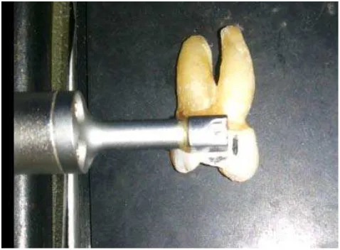 Gambar 13. Pengukuran kekasaran permukaan enamel gigi setelah diberikan perlakuan pada daerah yang ditandai spidol 