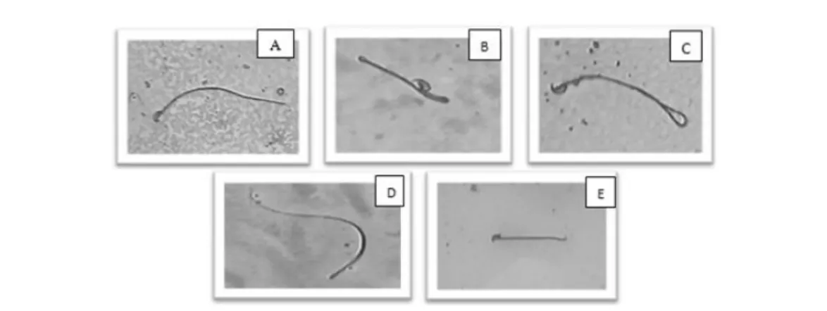 Gambar 3.   Bentuk-bentuk spermatozoamencit jantan galur Swiss dengan perbesaran 200x