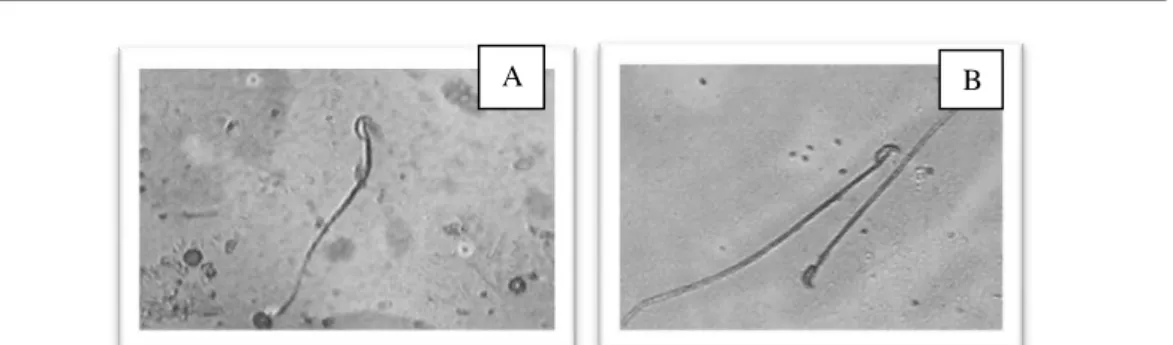 Gambar 5.   Perbedaan spermatozoa mencit jantan galur Swiss yang hidup dan mati dengan  perbesaran  200x