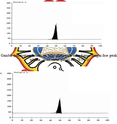 Gambar densitogram larutan uji  piroksikam pada suhu  kamar dengan fase gerak 