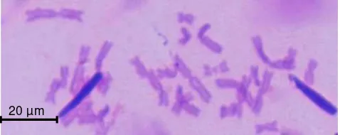 Gambar 1. Kromosom metafase R. Rufipes