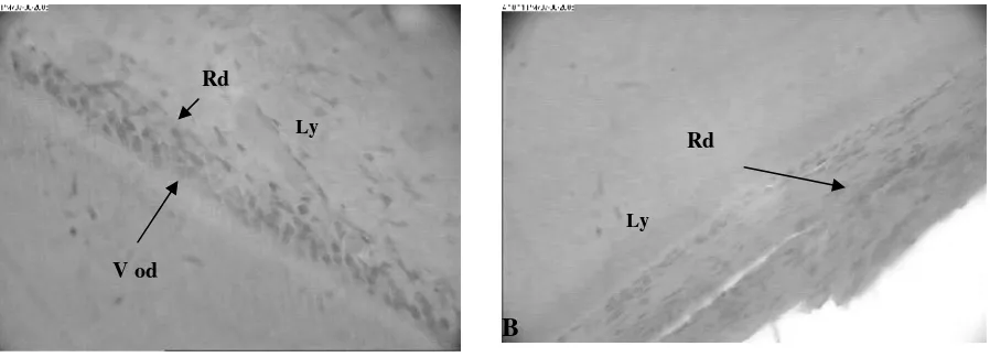Gambar 4. Pengamatan 6 jam pulpa yang diberi J. curcas 15% (A) dan eugenol (B).V od=vakuolisasiodontoblast, Rd=sel radang
