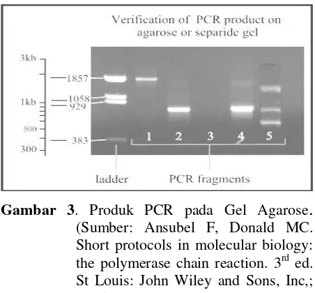 Gambar 3. Produk PCR pada Gel Agarose.(Sumber: Ansubel F, Donald MC.Short protocols in molecular biology:the polymerase chain reaction