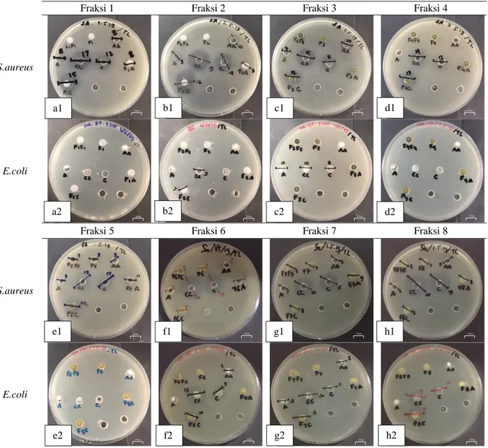 Gambar  2    Hasil  Pengujian  Bersama  Zona  Inhibisi  Fraksi  Tapak  Liman  dengan  Antibiotik  terhadap  Bakteri 