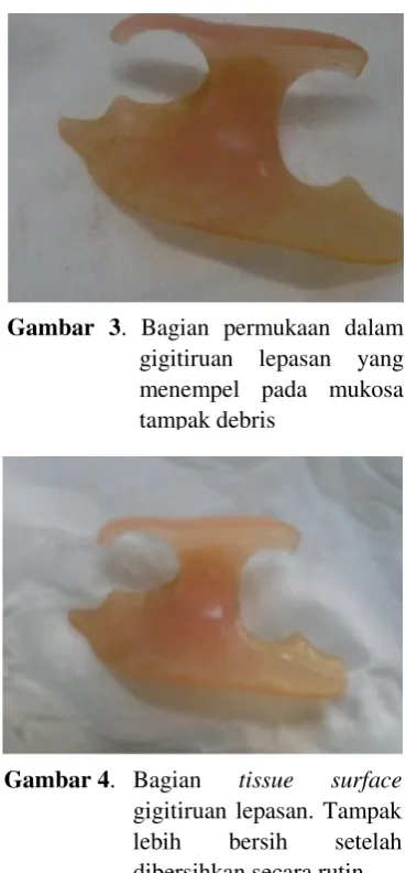 Gambar 3. Bagian permukaan dalam