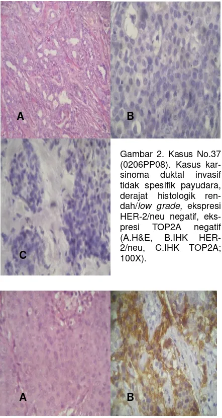 Gambar 2. Kasus No.37 