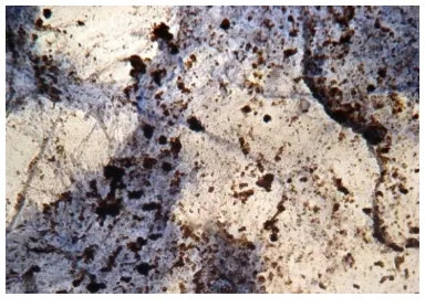 Gambar 2. Bercak-bercak gelap (dark Specks) pada latar belakang material Nekrotik granulat eosinofilik (MGG, x400) 