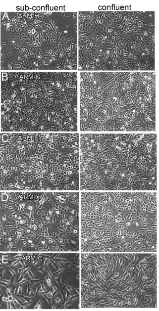 Figure 1. Phase contrast photomicrographs of breast cancer cell lines at sub confluent and confluent stages