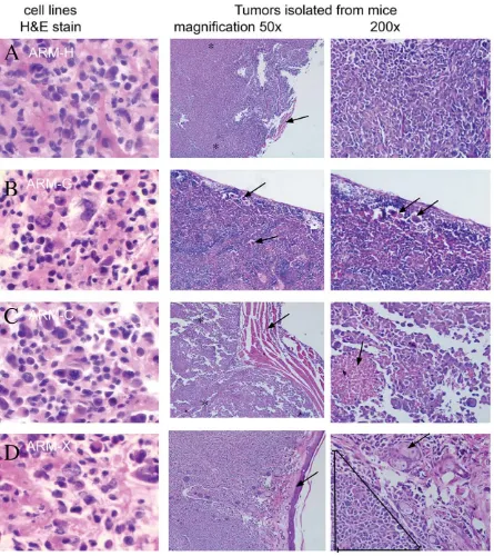 Figure 3. Photomicrographs of H&E stains of human breast cancer cell lines and metastatic tumors from mice