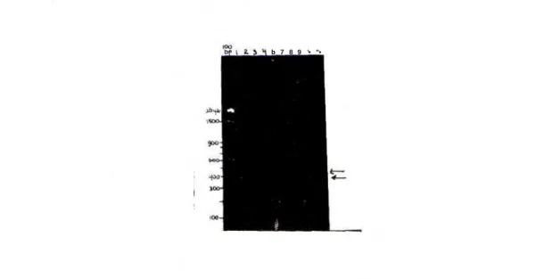 Gambar 1. Satu contoh pola keragaman fragmen DNA (alel spesifik) yang dihasilkan dalam analisis PCR dengan pnmer  B l l 