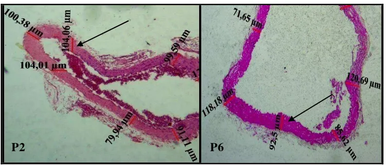 Gambar 10. Gambaran Mikrostruktur Dinding Aorta Mencit. Pewarnaan 