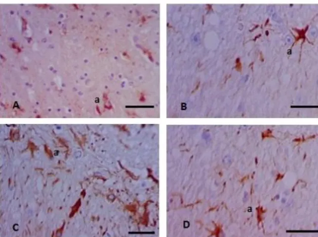 Gambar  3  menunjukkan  bahwa  otak  marmut  yang  dikastrasi  mengalami  peningkatan  aktivitas  sel-sel  glia  yang  diamati  menggunakan  antibodi  GFAP
