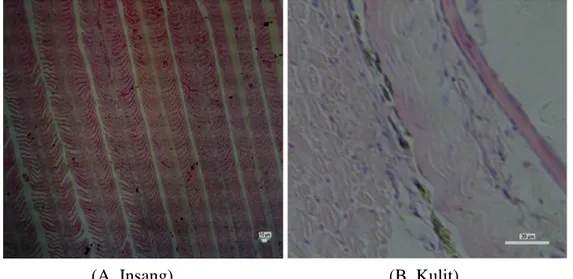 Gambar 1 Histopatologi (A) insang dan (B) kulit Ikan Komet (Perlakuan A. 25 0 C) 