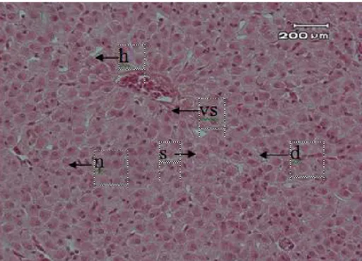 Gambar 2. Struktur Mikroskopis Hati Ikan Seurukan dari Sungai Krueng Sabee dengan Pewarnaan HE  dan Pembesaran 400x,  vs: Vena  Sentralis,  h: Hepatosit (sel  hati),  s: Sinusoid,  d: Degenerasi, dan n: Nekrosa