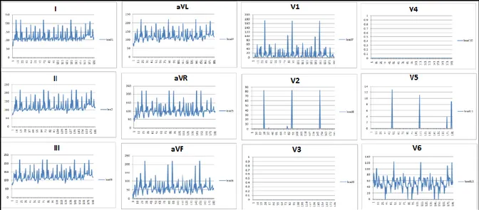 Gambar 19. Plot Grafik Data EKG 12  Lead  dengan  Delay  Multiplekser 5ms    