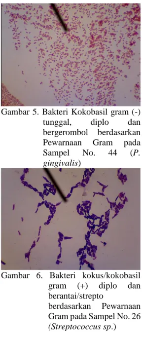Gambar  4.  Bakteri  Kokus  gram  (+)  tunggal,  diplo  dan  bergerombol  berdasarkan  Pewarnaan  Gram  pada  Sampel  No