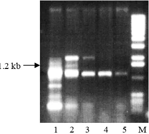 Figure 2. Electrophoresis profile of DNA fragments amplified from sugarcane 