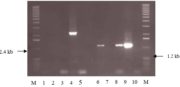 Figure 3.  PCR results using primers of start-stop (lanes 1-5) and CRF-CRR (lanes 6-10)