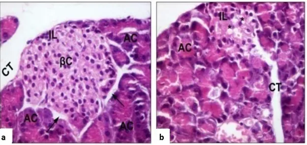 Gambar 2.4 Fotomikrograf Pankreas Tikus dengan Pewarnaan HE dan Perbesaran 400x. a) Pankreas kelompok kontrol menunjukkan struktur normal dari pulau Langerhans (IL), sel  β (βC), sel asinar (AC), dibatasi oleh daerah endokrin dan eksokrin yang berbeda (pan