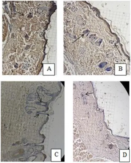 Figure 3.NFκβ expression on immunohistochemistry. A =Normal Group (K0), B = Treatment Group -1 (P1),C = Treatment Group -2 (P2), D = TreatmentGroup -3 (P3) using binocular microscope with400 times enlargement