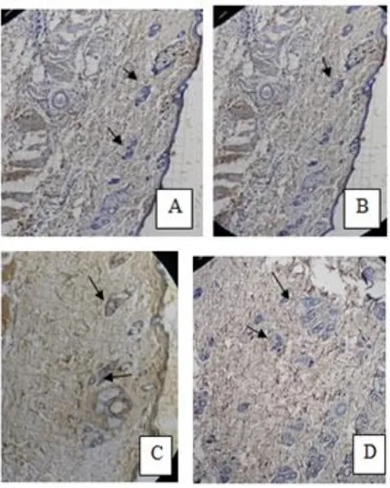 Figure 5. FGF expression on immunohistochemistry. A= Normal Group (K0), B = Treatment Group-1 (P1), C = Treatment Group -2 (P2), D =Treatment Group -3 (P3) using binocularmicroscope with 400 times enlargement.*arrows point to FGF