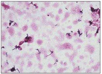 Gambar 2.8 Propionibacterium acne 