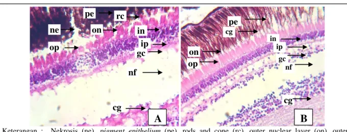 Gambar  4.    Histopatologi  Mata  Ikan  Gurami  (O.  gouramy)  dengan  Pewarnaan  H-E  (Perbesaran  400x),               (A) Jaringan mata ikan gurami Sakit, (B) Jaringan mata ikan normal, 