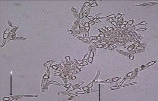 Gambar 1. Hialin teliospora dari Puccinia horiana (A) dan tangkai teliospora (B) (Szakuta dan Butrymowicz 2004).