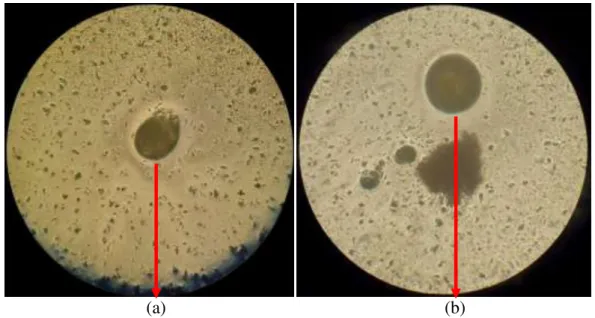 Gambar 1. Spora jamur P. palmivora yang menempel di kaca preparat (perbesaran 10x 40)  a