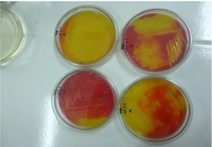 Gambar 8. Hasil inokulasi biakan bakteri pada BGA dan XLD 