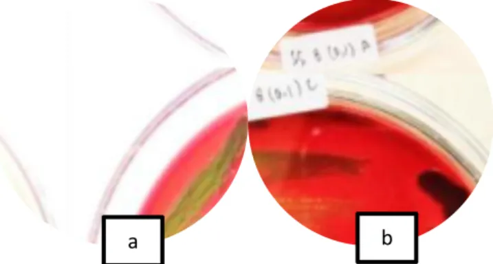 Gambar 4.3 Koloni bakteri koliform dalam media EMBA, a) koloni hijau  metalik dan koloni merah muda, b)