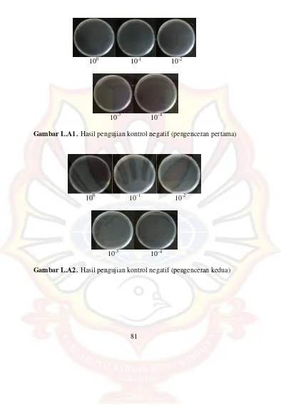 Gambar L.A1.  Hasil pengujian kontrol negatif (pengenceran pertama) 
