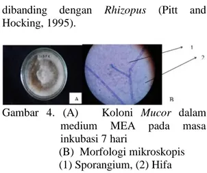 Gambar  3.    (A)      Koloni  Fusarium  dalam  medium  MEA  pada  masa  inkubasi 7 hari  