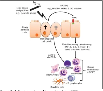 Gambar 3.  Aktivasi sistem imun oleh kematian sel pada PPOK. Keterangan: DAMP: Damage associated molecular patterns, HMGB1: High mobility group box 1, HSP: Heat shock proteins, PRR: Pattern recognition receptors, TNF: Tumor necrosis factor, IL: Interleukin