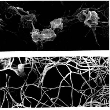 FIGURE 12.3 (Top) Activated platelets and (bottom) a blood clot containing a fibrin net work and trapped red blood cells