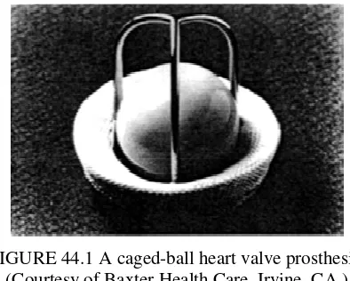 FIGURE 44.1 A caged-ball heart valve prosthesis. 