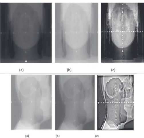 Gambar 3: EPID (a) sebelum diolah; (b) setelah penyesuaian skala dan pengaturan kontras; (c) setelah filter dengan metode convolve dan unsharp mask.