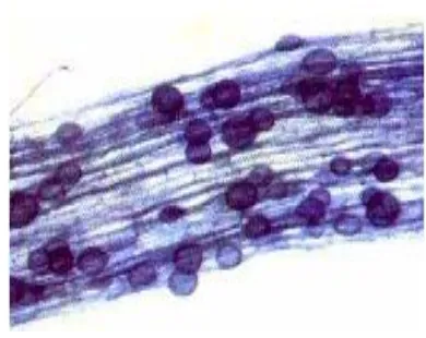 Gambar  17. Cendawan Ustilago maydis parasit pada jagung yang menyebabkan penyakit gosong,Sumber Campbell 2006 